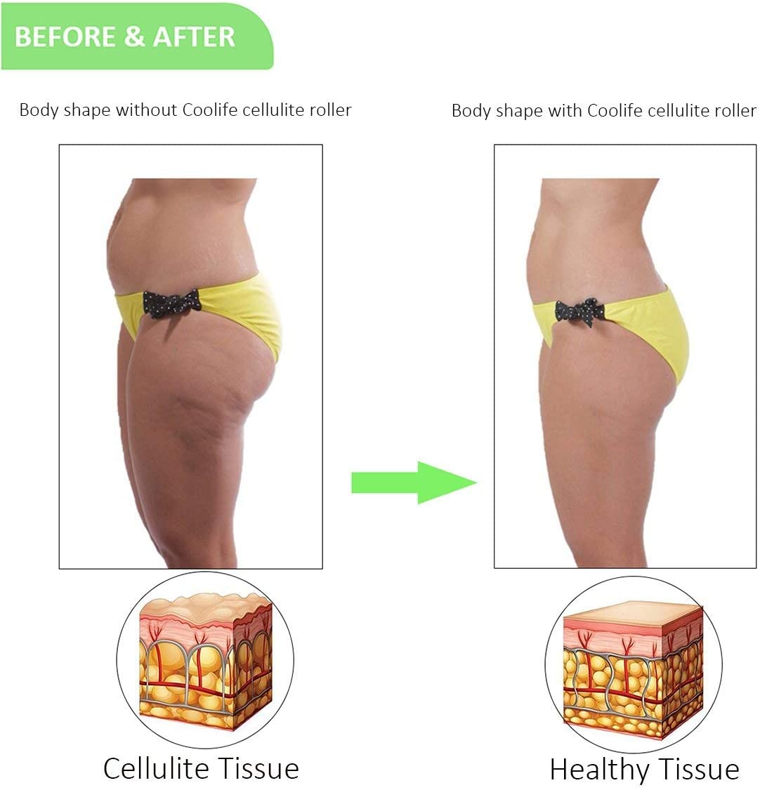 Fascia Roller